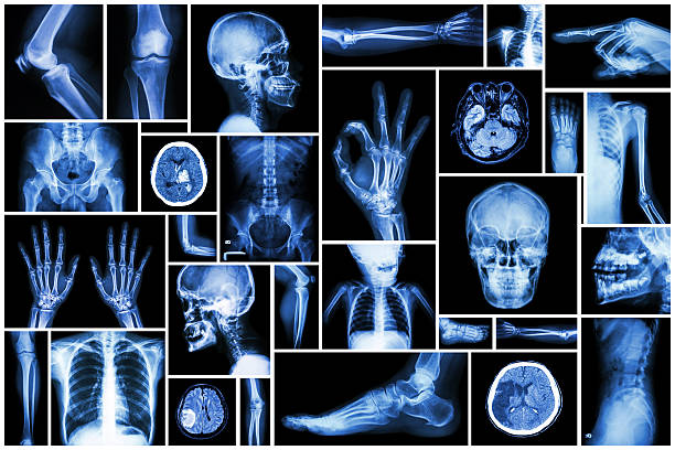 kollektion x-ray mehreren teil der - x ray x ray image human hand anatomy stock-fotos und bilder