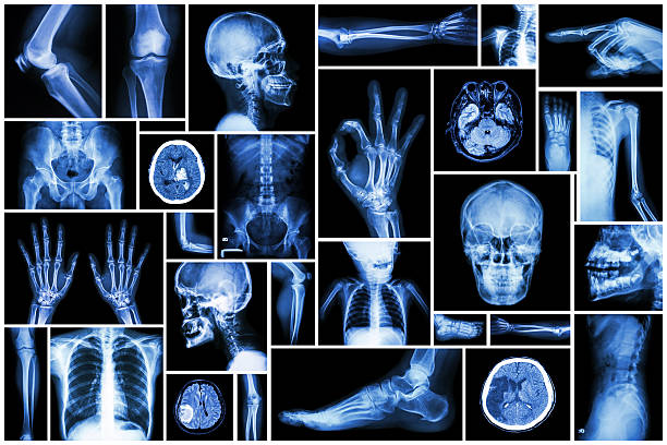 istock Collection X-ray multiple part of human 499805989