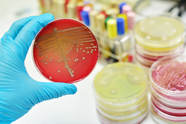 bakterien kultur mittlere plate - blood agar stock-fotos und bilder