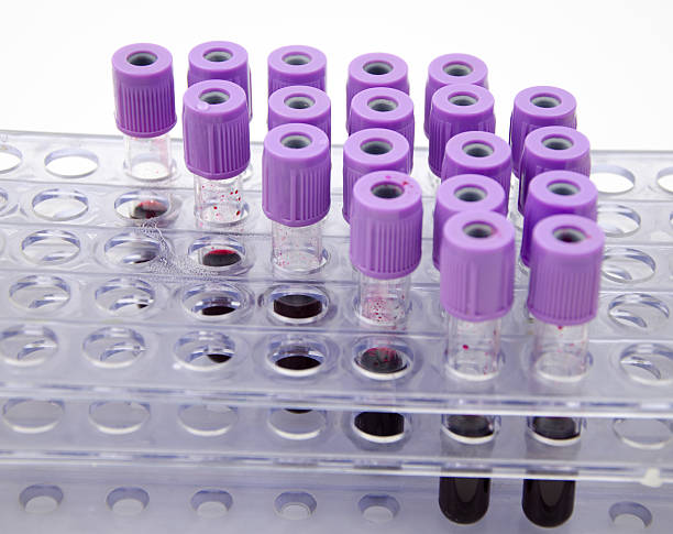 istock Blood collection tube 499980609