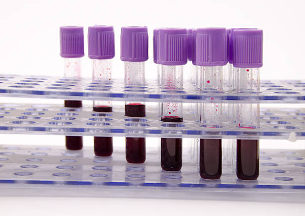 istock Blood collection tube 499980611