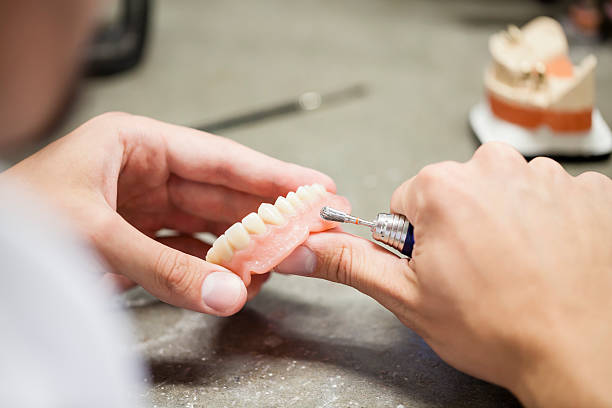 dentista lavorando su un dention tecnico - laboratory dentures dental hygiene human teeth foto e immagini stock