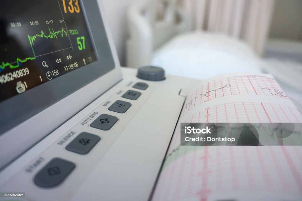 Fetal Monitor Details Fetal Monitor Details in Hospital Room Electrocardiography Stock Photo