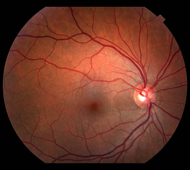 인간 눈 - animal retina 뉴스 사진 이미지
