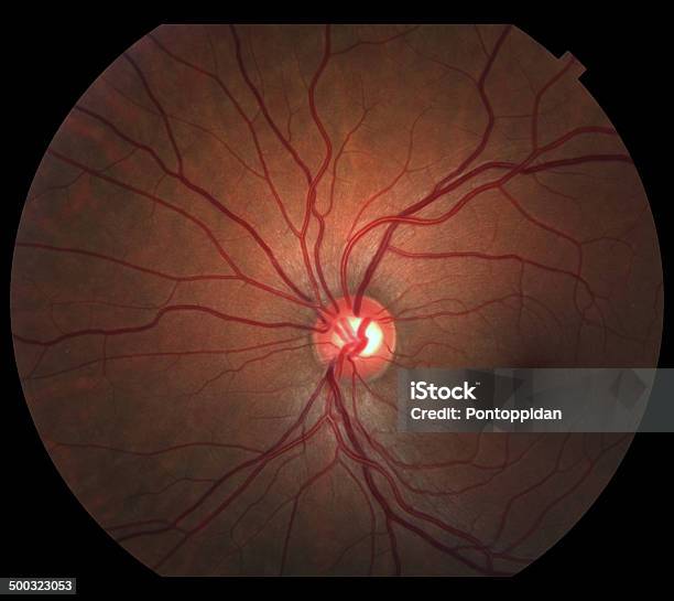 Olho Humano - Fotografias de stock e mais imagens de Disco Ótico - Globo Ocular - Disco Ótico - Globo Ocular, Olho, Papila