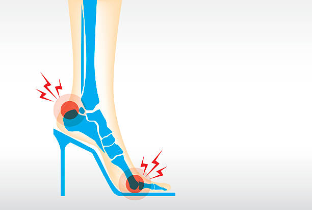 ilustrações, clipart, desenhos animados e ícones de dores nos pés usando saltos alto. - shoe high heels tall women
