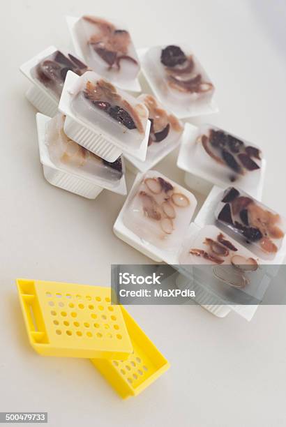 Empty Tissue Block Stack Of Histology Tissue Block With Cassette Stock Photo - Download ...