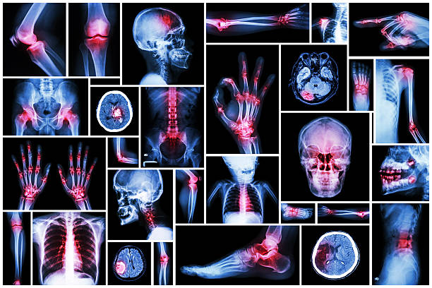 x-ray plusieurs partie humaine, avec plusieurs maladie - x ray x ray image human hand anatomy photos et images de collection