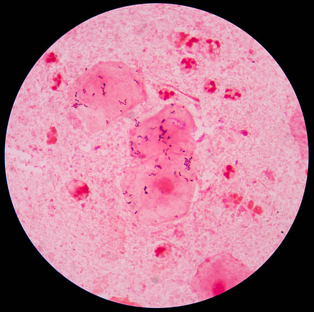 istock red leukocyte in sputum gram stain with bacteria 500534292