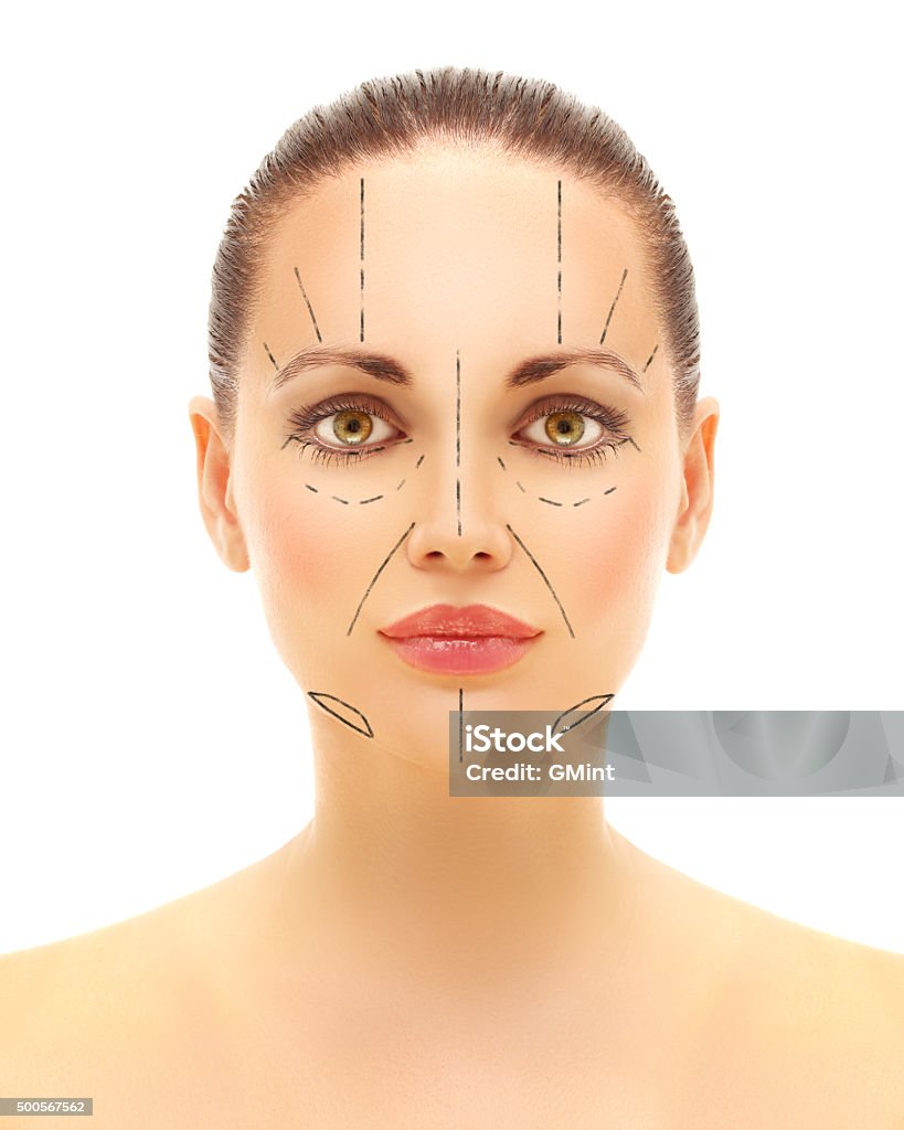 Pre-operative markings 2015 Stock Photo