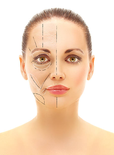 istock Pre-operative markings and  demonstration where the fat will be placed 500567640