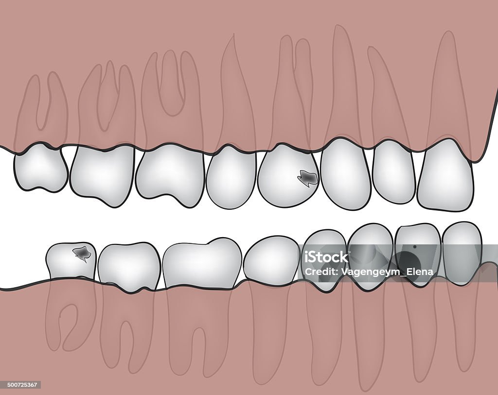 jaw - Ilustração de Arte royalty-free