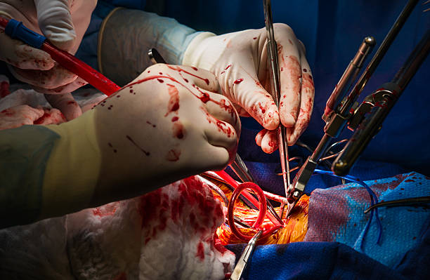 кровотечение во время каротидная эндартерэктомия сосудистая хирургия - surgery human artery human hand carotid artery стоковые фото и изображения