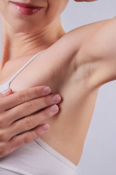 istock Armpit epilation, lacer hair removal. 500875466