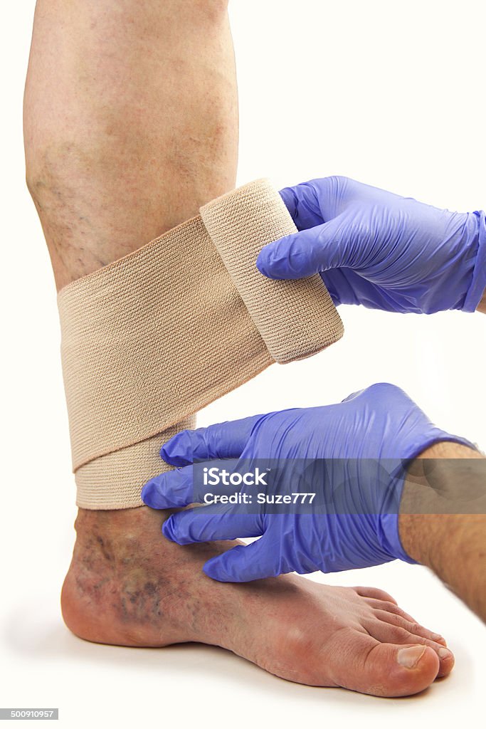 Varicose veins and bandage Varicose veins and bandage. Isolated on white backgroundVaricose veins. Medical treatment. Isolated on white background Bandage Stock Photo