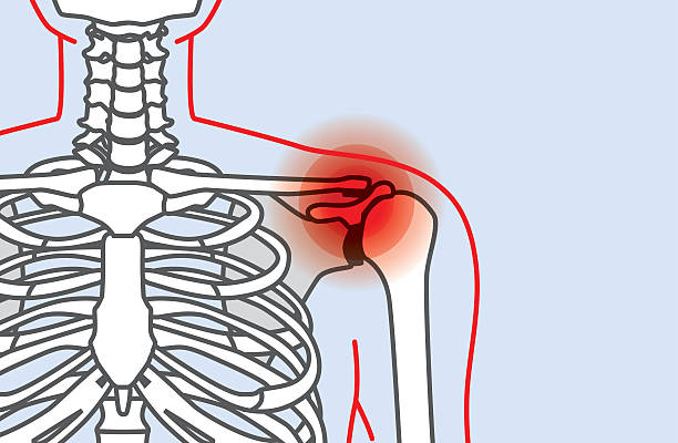 肩に痛みのアウトライン - human muscle the human body anatomy body点のイラスト素材／クリップアート素材／マンガ素材／アイコン素材