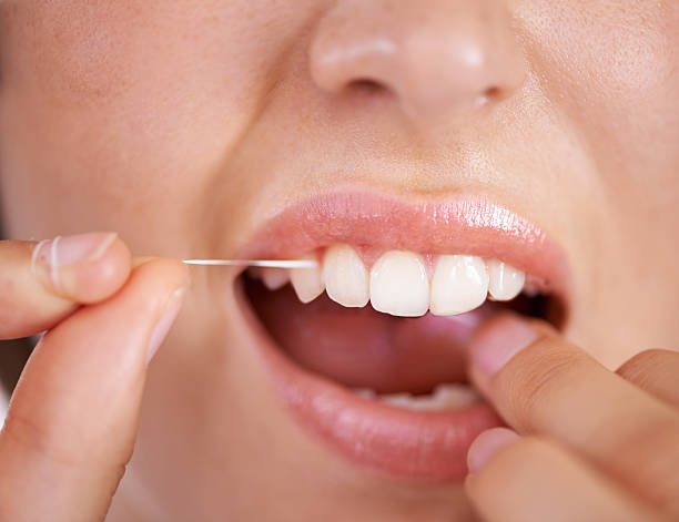 istock Just a bit of work for the perfect smile 501058679