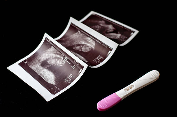 istock pregnancy test and ultrasound pictures 501059276