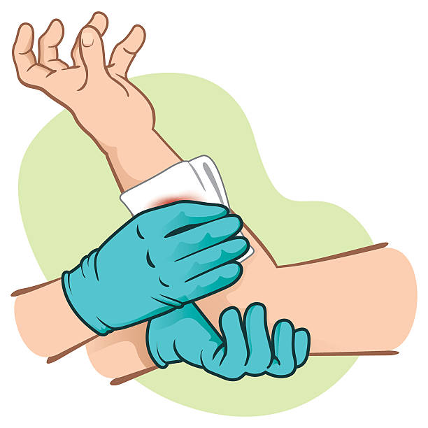 первой помощи, кровотечение в группе контроля повышения ранения. tm - hand in latex glove stock illustrations