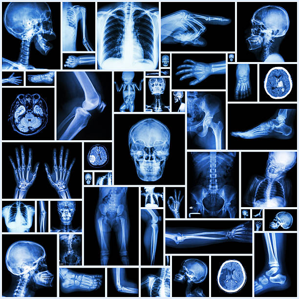 coleção de vários parte do homem raios x - cat scan pelvis hip human spine - fotografias e filmes do acervo
