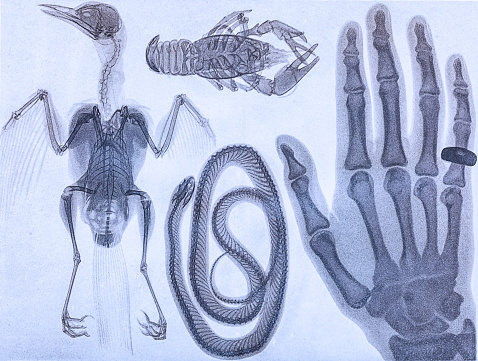 X ray image of human hand with a ring ,bird ,snake and crab