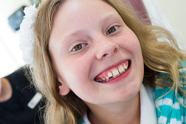 istock Girl proudly shows off her first orthodontic bracket 501343144