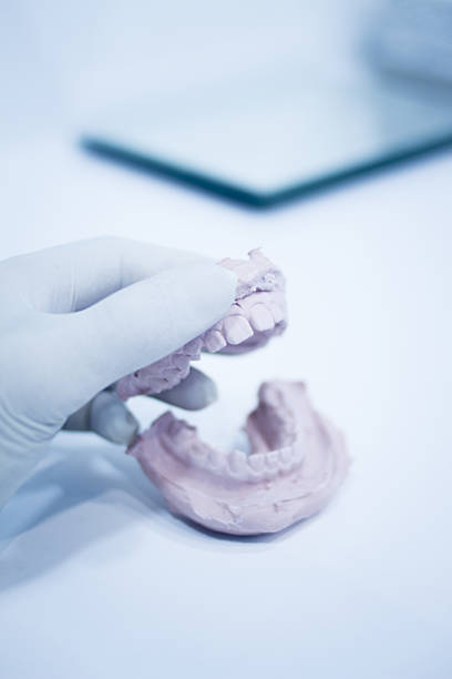 istock Dental mold dentists clay teeth ceramic plate cast 501433538