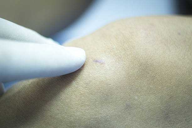 istock Patient leg in physical therapy physiotherapy 501546632