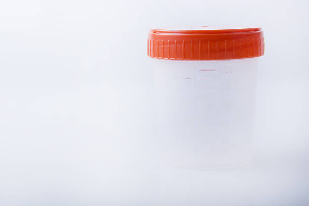 istock Medical Urine Specimen Jar 501579862