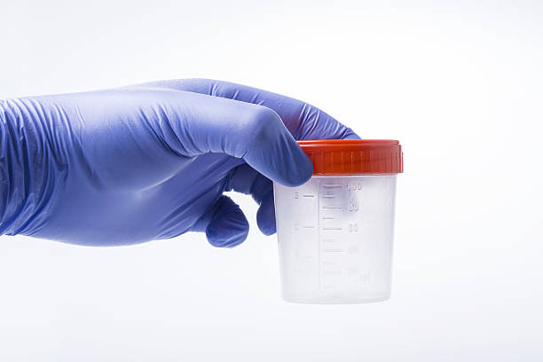 medyczne pojemnik na próbkę moczu - flu bug zdjęcia i obrazy z banku zdjęć
