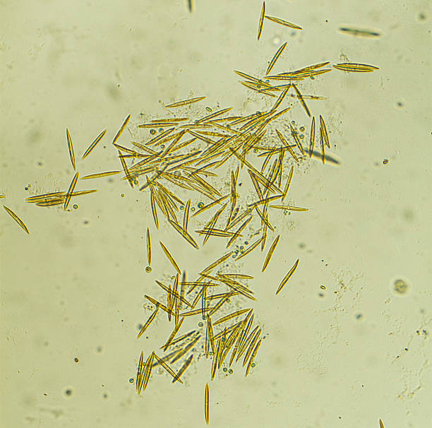 microrganismos-diatoms - algae diatom high scale magnification micro organism imagens e fotografias de stock