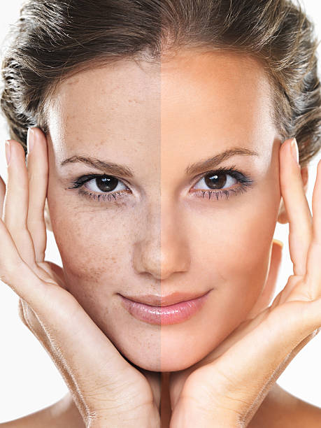 istock To tan or no to tan?! 501651625