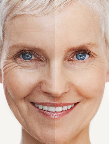 Before and after shot of a beautiful senior woman's facehttp://195.154.178.81/DATA/i_collage/pi/shoots/783435.jpg