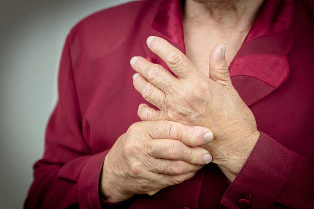artrite reumatoide mani - artrite foto e immagini stock
