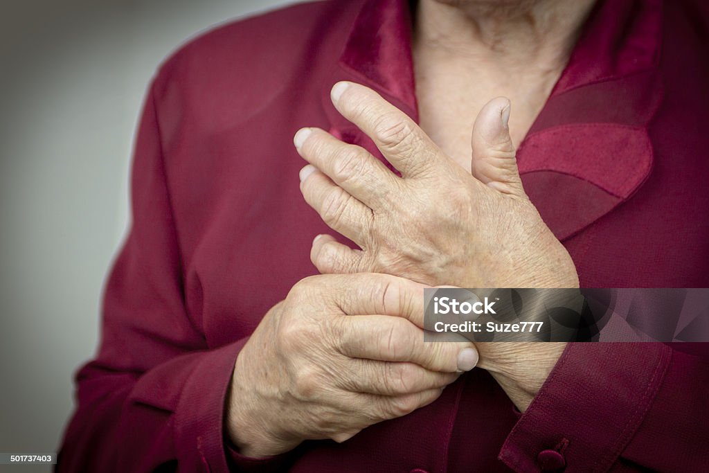 Rheumatoid arthritis hands Hands Of Woman Deformed From Rheumatoid Arthritis. PainRheumatoid arthritis hands. MacroRheumatoid arthritis hands. Macro Rheumatoid Arthritis Stock Photo