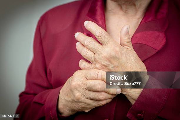 Rheumatoid Arthritis Hands Stock Photo - Download Image Now - Rheumatoid Arthritis, Osteoarthritis, Patient