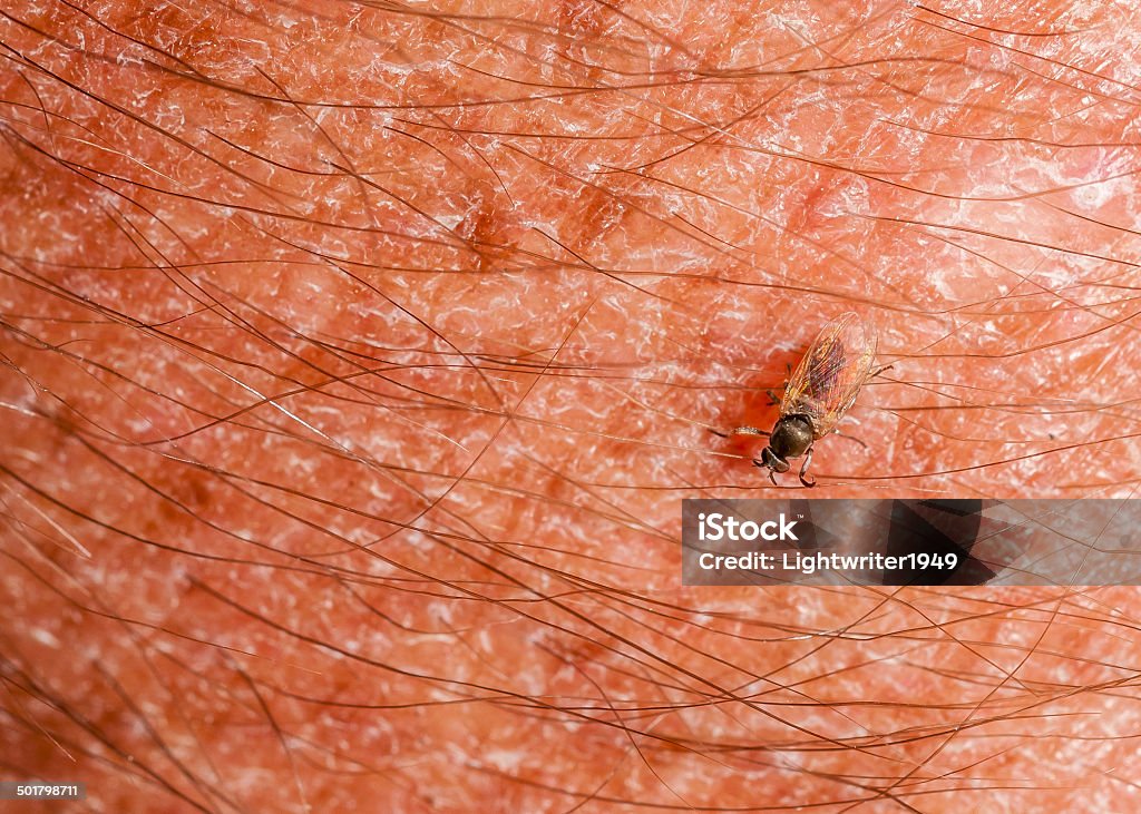 Gnat Biting Arm Gnat Biting Arm closeup demonstrating how they are. Black Fly Stock Photo
