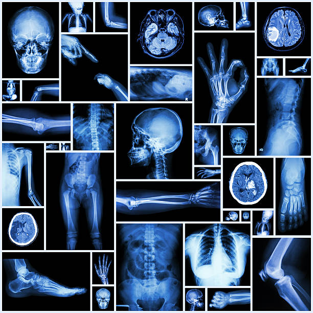 x-ray várias parte da humanidade - cat scan pelvis hip human spine - fotografias e filmes do acervo