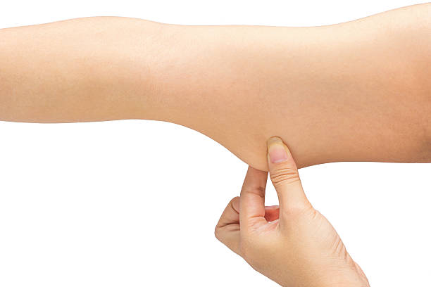 istock Woman testing the flabby muscle under her arm pulling 501914392