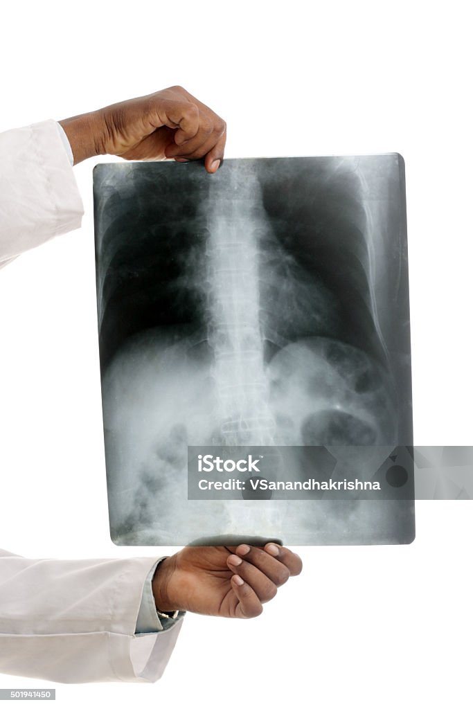 Doutor examinando o raio-X - Foto de stock de 2015 royalty-free