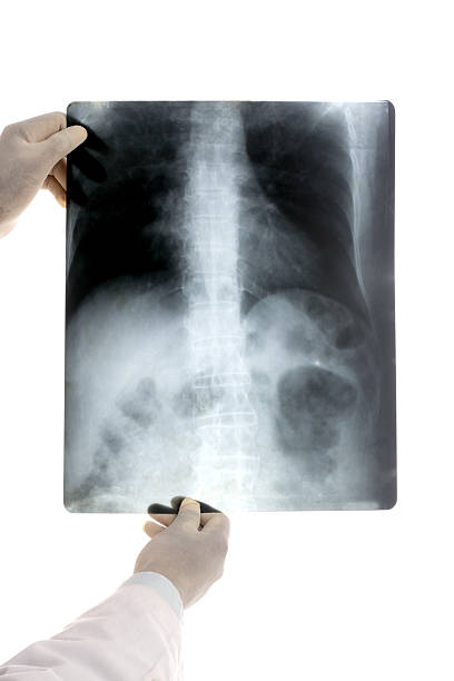 lekarz badanie rtg - animal skeleton zdjęcia i obrazy z banku zdjęć