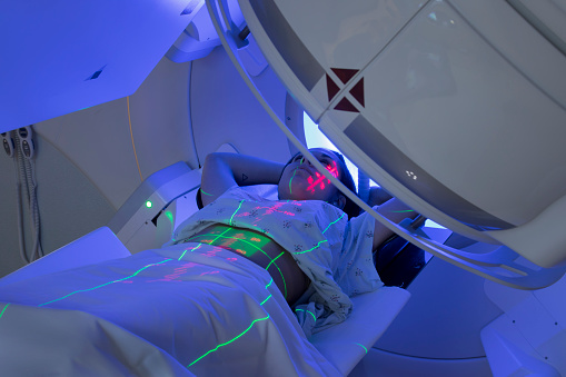 Mujer recibiendo radioterapia tratamientos para el cáncer photo