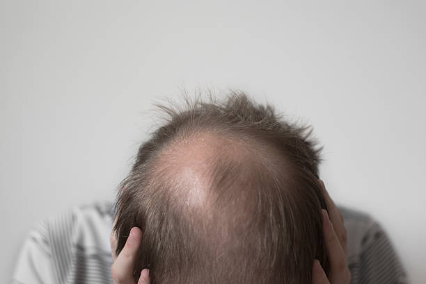 Ugly Skinny Guy Stock Photos, Pictures & Royalty-Free Images - iStock Ugly Skinny Guy Stock Photos, Pictures & Royalty-Free Images - iStock