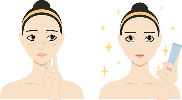 Girl with freckles and without it Cute cartoon girl with freckles shows the result of using cosmetic. Colorful vector sad pretty woman with skin pigmentation and happy with tube of whitening cream, foundation, consealer or BB/tone cream. freckle stock illustrations