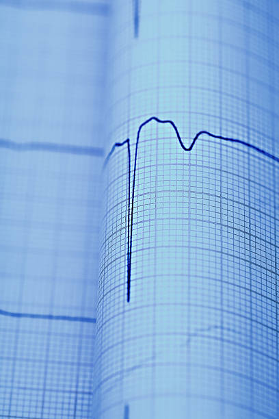 istock ECG macro as a medical diagnostic concepts 502160374