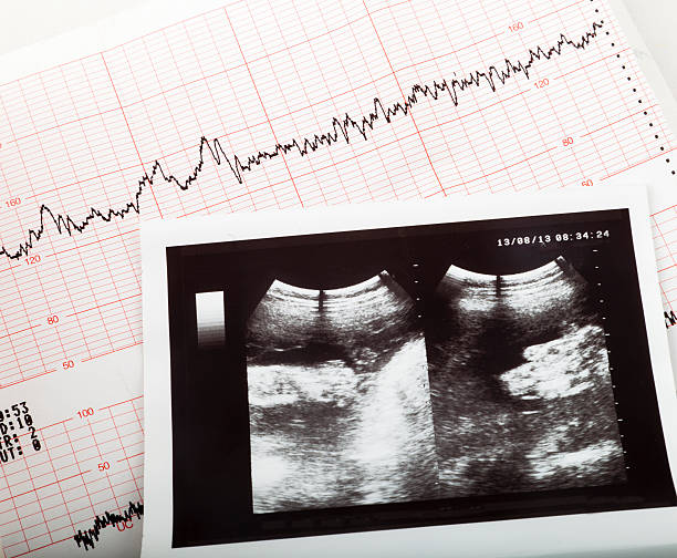 ultraschall-ergebnis der fötus und cardiogram des babys - fetus stock-fotos und bilder