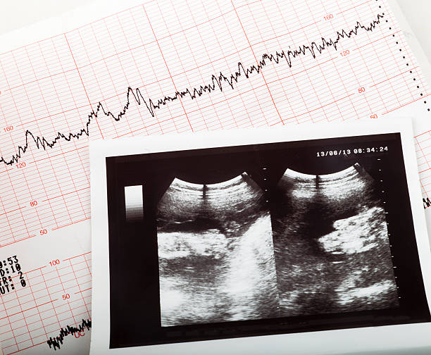 ultrasonic result of the fetus and cardiogram of the baby ultrasonic result of the fetus and cardiogram fetus stock pictures, royalty-free photos & images