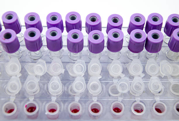 Blood collection tube