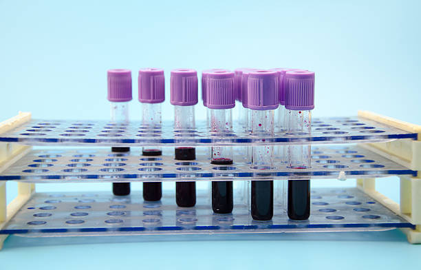 istock Blood collection tube 502221945