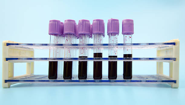 istock Blood collection tube 502221987